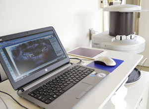 （左）ビスタスキャンプラス：ヨシダ